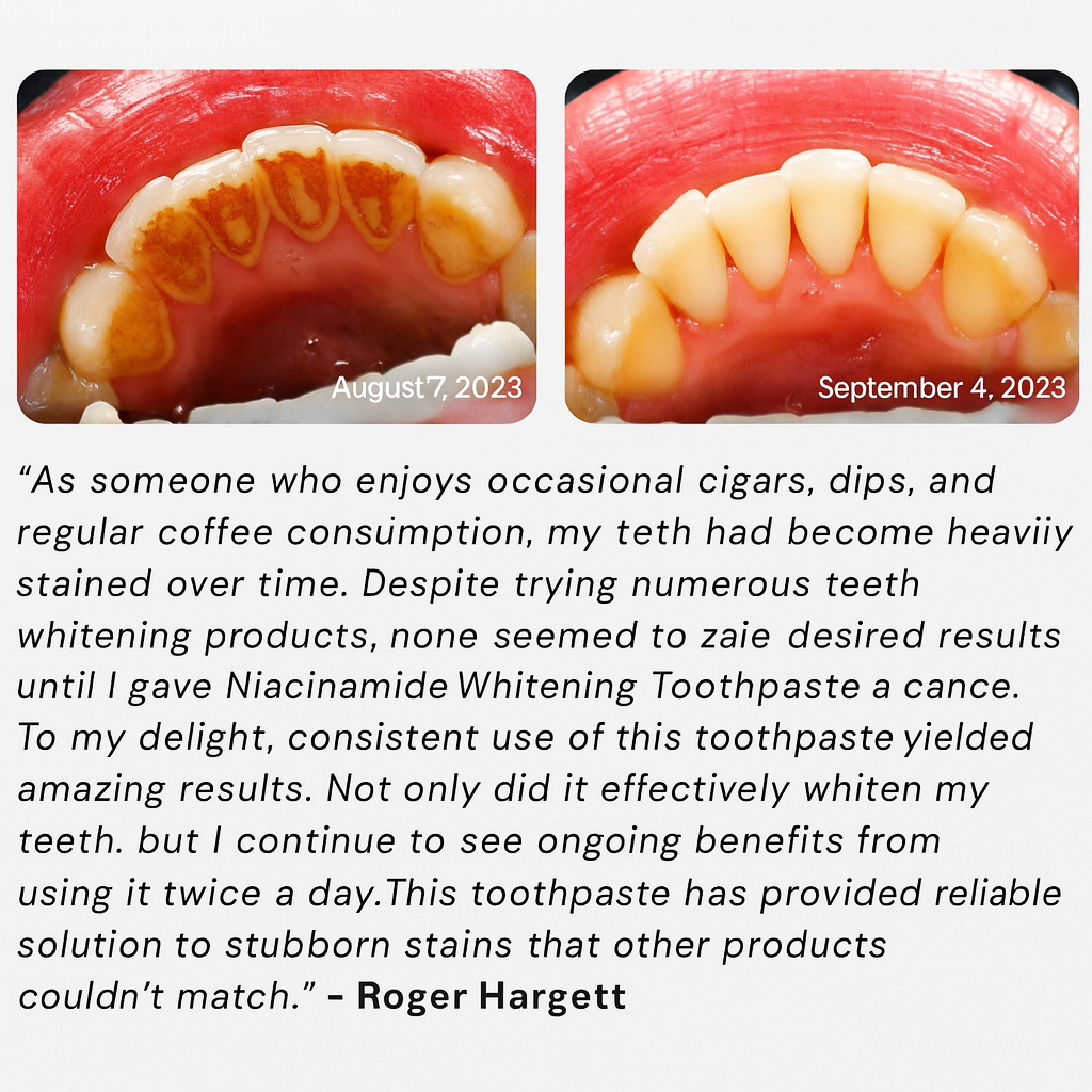 GlowDent™ Whitening Toothpaste