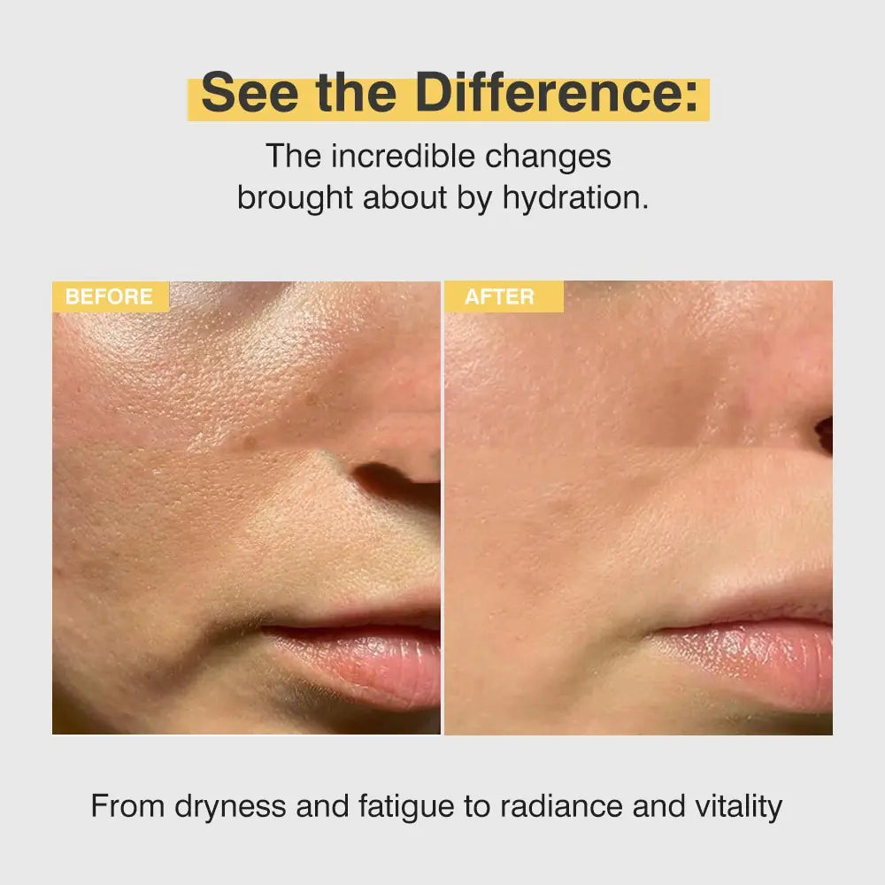 Skinova™Collagen Anti-Wrinkle Cream