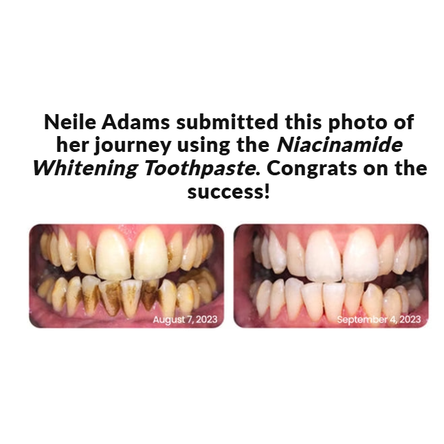 GlowDent™ Whitening Toothpaste