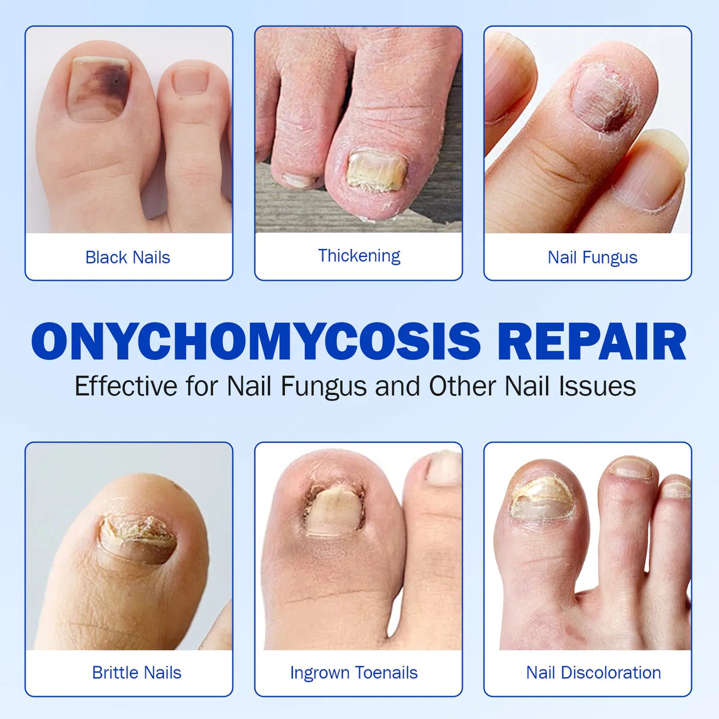 FungiCare Nail Repair Patches™