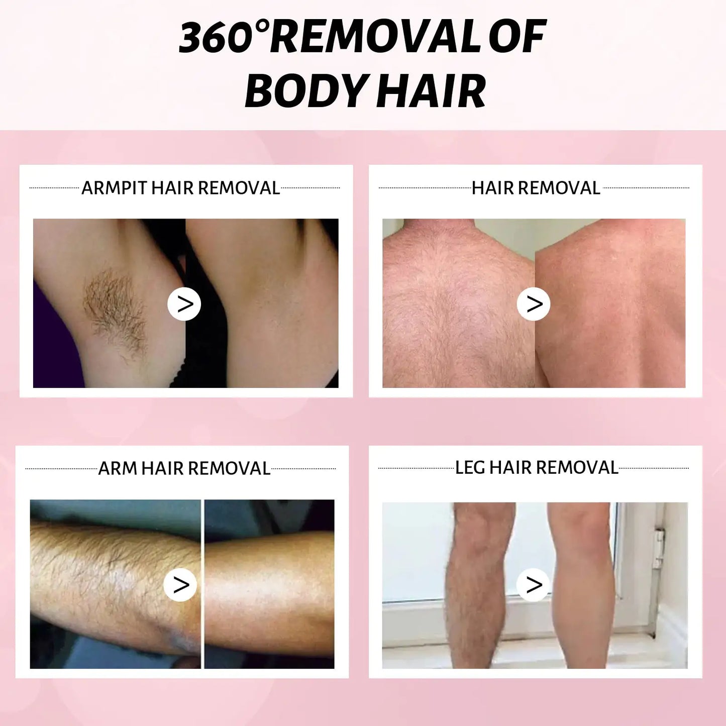 Mu Si Honey Hair Removal Spray Removes All Over The Body