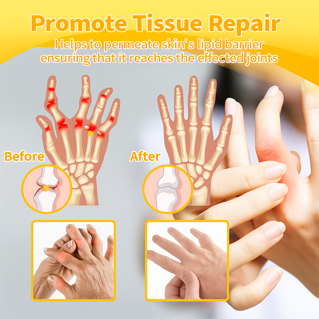 VenomEase™Bee Pain Relief Cream