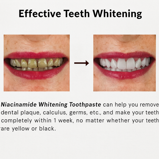 GlowDent™ Whitening Toothpaste