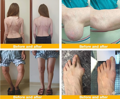 VenomEase™Bee Pain Relief Cream