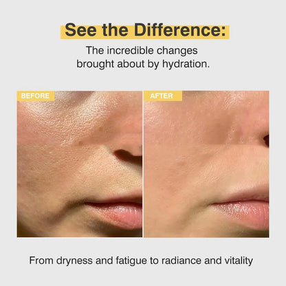Skinova™Collagen Anti-Wrinkle Cream
