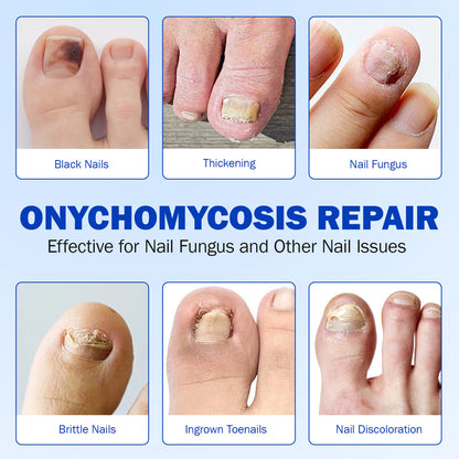 FungiCare Nail Repair Patches™